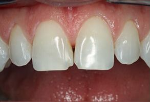 First Family Dental | Dentures, Emergency Treatment and Veneers